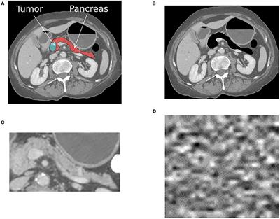 Detecting Spurious Correlations With Sanity Tests for Artificial Intelligence Guided Radiology Systems